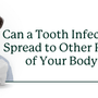 Can a Tooth Infection Spread to Other Parts of Your Body?