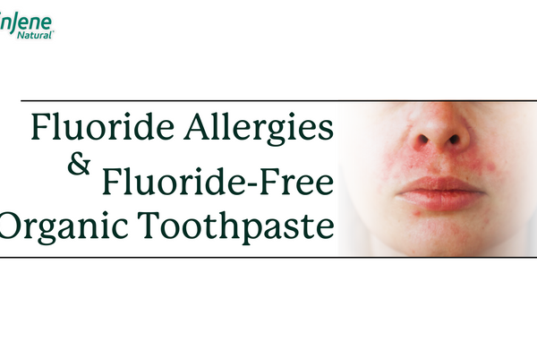 Fluoride Allergy