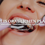 What is Oral Lichen Planus? Plus, a Customer's Testimonial on SprinJene Natural Toothpaste